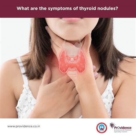 Thyroid Nodules