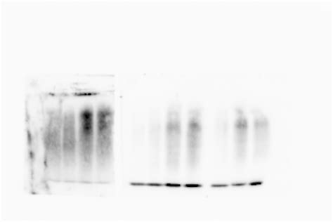 Can You Show The Picture Of Your Worst Western Blot And Explain The