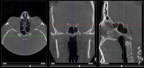 MP CBCT Radio Anatomy Imaging