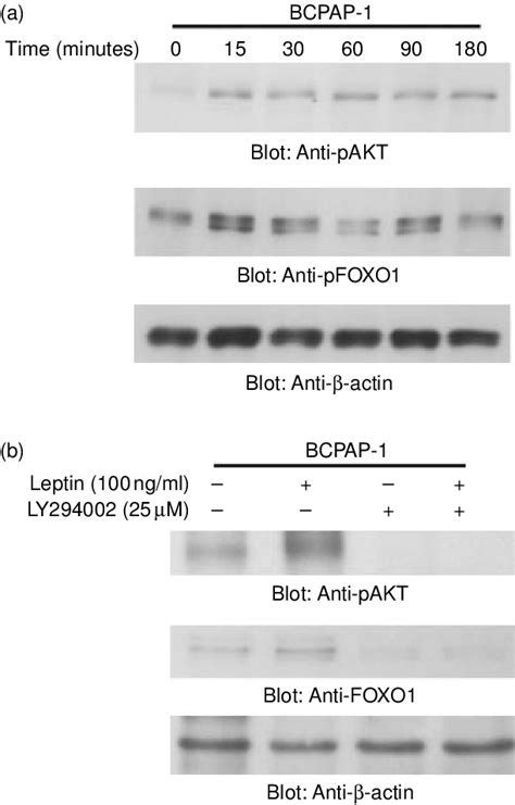 Leptin Activates Pi3 Kinaseakt Signaling Pathway A Bcpap Cells Were