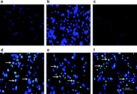 Intracellular Zinc Levels And Expression Of Znt In Zinc Sufficient