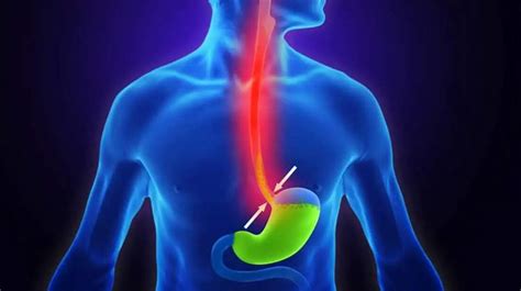 Esophageal Cancer Treatment in India - Causes, Hospitals