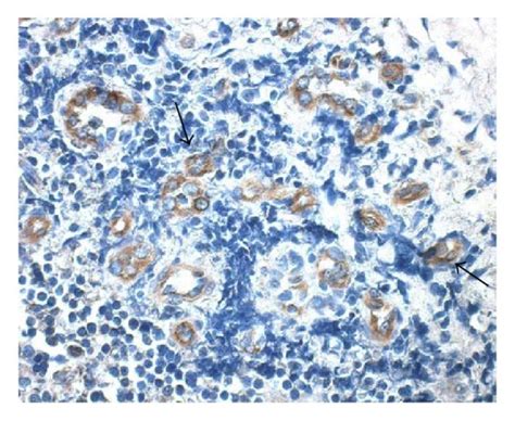 Immunohistochemical staining of IFN λ2 in human tonsil lung and nasal