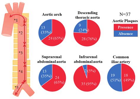 Distribution Of All Atherosclerotic Plaques At Each Segment Of The