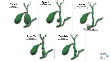 Gallbladder And Biliary Pathology Sonographic Tendencies