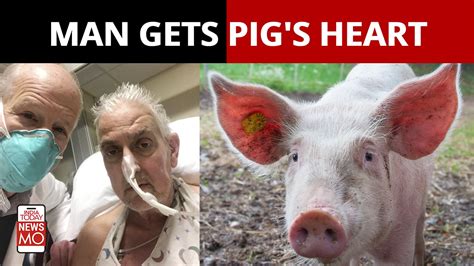 Us Surgeons Successfully Implant Pig S Heart In Human India Today