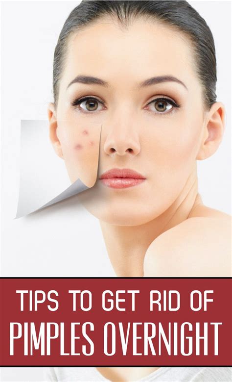 6 Ways To Help Get Rid Of Pimples Artofit