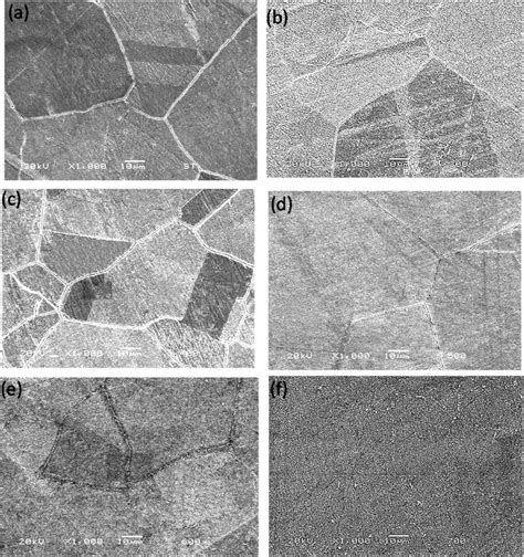 Brass Metallurgical Microstructure 1000X Magnification Of Samples A