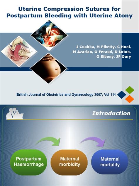 Uterine Compression Sutures For Postpartum Bleeding With Uterine Atony With Flash Pdf