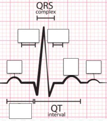 Normal Waveforms of an EKG - Labeling | Quizalize