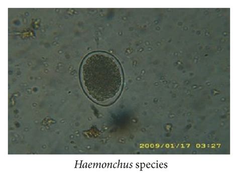 Eggs Of Nematodes As Seen Under The ×40 Objective Of The Microscope On Download Scientific