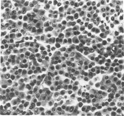 High Magnification Of Infiltrating Lymphocytes In The Mesenteric Lymph Download Scientific