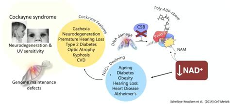 Covid 19 And Progressive Progeria Wmc Research