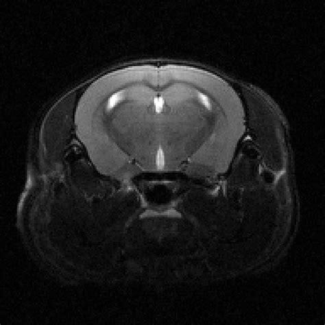 Mouse Brain Anatomical MRI 2D Biomedical Research Imaging Center