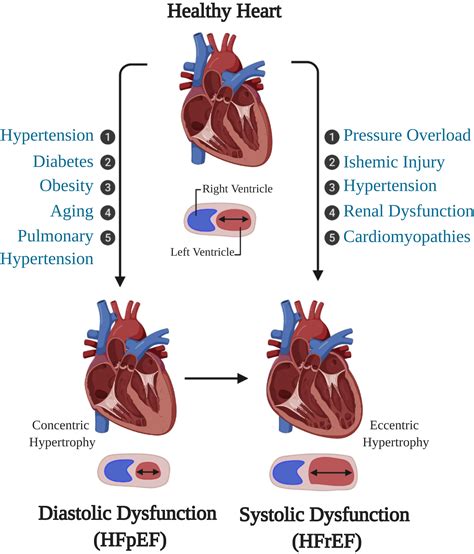 Mouse Models Of Heart Failure With Preserved Or Reduced Ejection