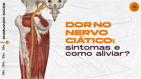 Dor no nervo ciático sintomas e como aliviar YouTube