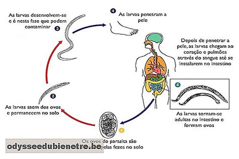 Cómo Identificar Y Tratar La Anquilostomiasis Esodysseedubienetrebe