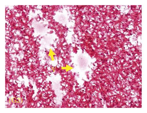 (a–d) Histology of kidney. G1 showed normal structure of renal tubules ...