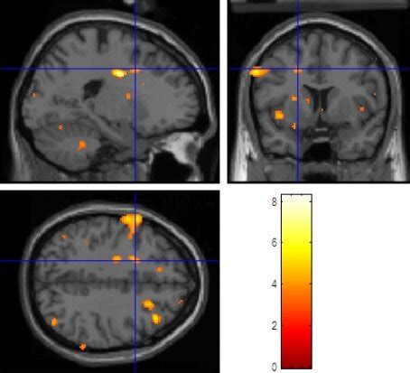 fmri scan showing brain activity  scientific diagram