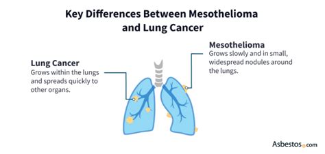 Mesothelioma vs. Lung Cancer | My Resource Guide