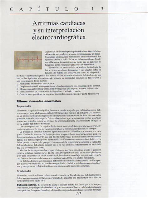 PDF Capitulo 13 arritmias cardíacas y su interpretación PDFSLIDE TIPS