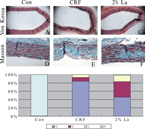 Representative Histochemical Micrographs Of Von Kossa Staining Download Scientific Diagram