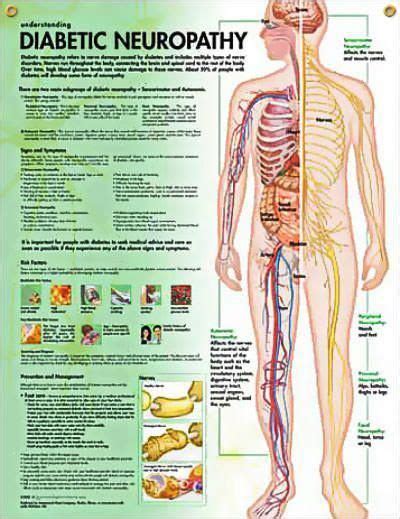 The Spinal Nerves Chart 20x26 In 2020 Diabetic Neuropathy Reverse Diabetes Neuropathy