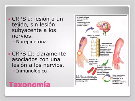 S Ndrome De Dolor Regional Complejo Ppt