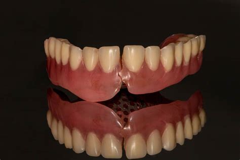 4 Signs That You Might Need Denture Repair Light Breeze Dental Irvine