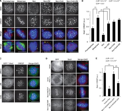 Figure 1 From Aurora B Controls Kinetochoremicrotubule Attachments By