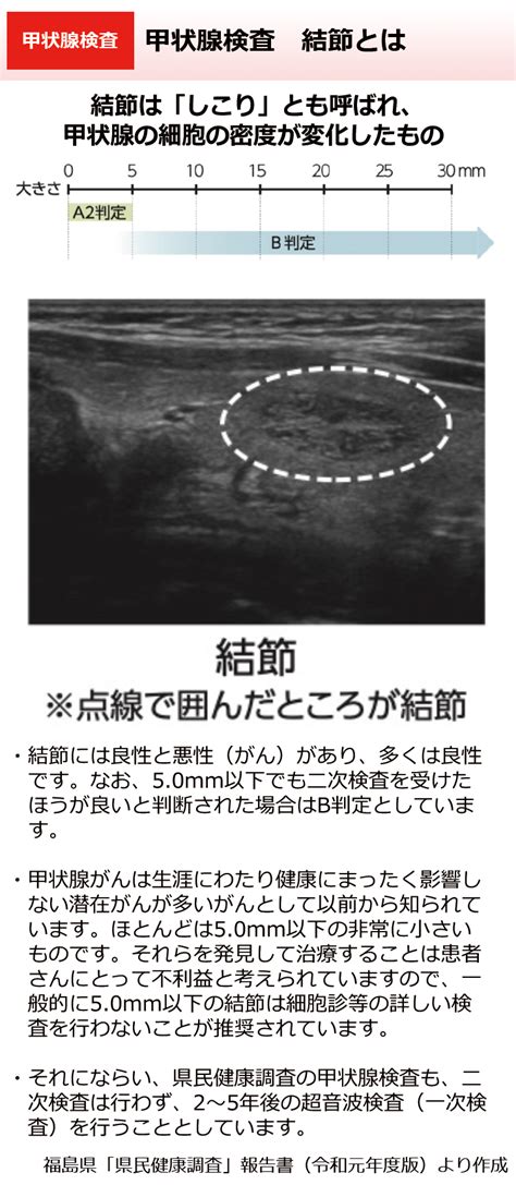 環境省甲状腺検査 結節とは