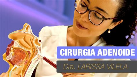 Cirurgia De Adenoide Quando Indicada Como Feita Como O P S