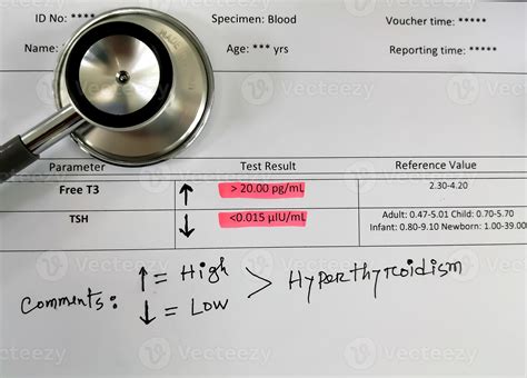 Abnormal Thyroid Report Isolated With Stethoscope Hyperthyroidism