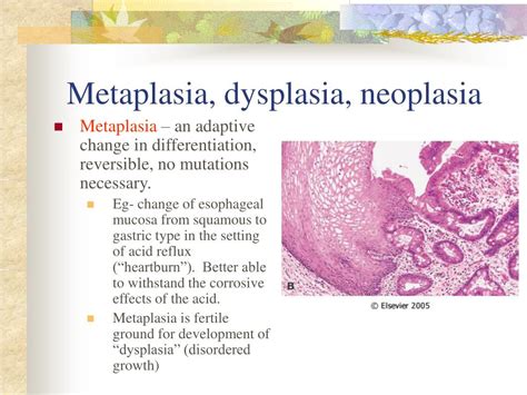 Ppt Neoplasia Powerpoint Presentation Free Download Id 6111587