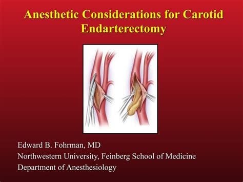 Edward Fohrman Anesthetic Considerations For Carotid Endarterectomy Ppt