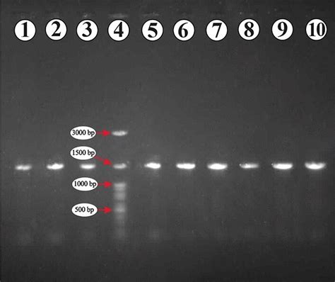 Gel Electrophoresis Of Pcr Products Pcr Products Of 16s Rdna Of