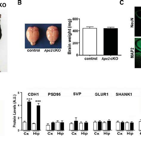 Normal Brain Morphology In Apc2 CKO Mice A Image Of An Apc2 CKO