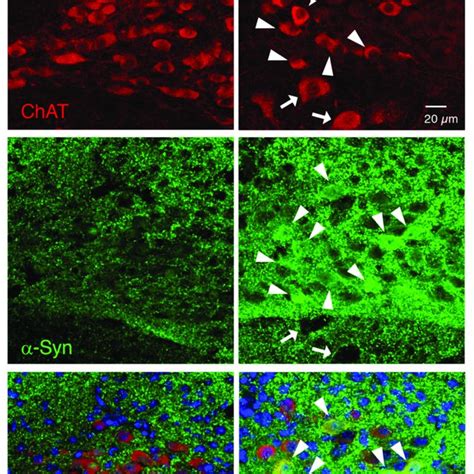 Chronic Exposure To Low Dose Rotenone Induced α Syn Accumulation In The