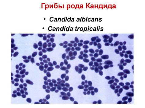 Кандида в кале у грудничка: норма, лечение, отзывы