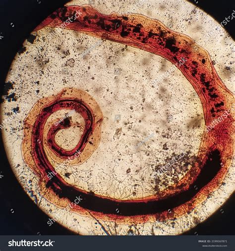 Trichuris Trichiura Under Microscope Human Parasite Stock Photo