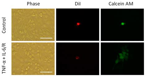 Medicina Free Full Text Differentiation Of Tumorigenic C Glioma