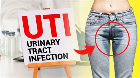 Solusyon Sa Pabalik Balik Na UTI O Urinary Tract Infection I Mga