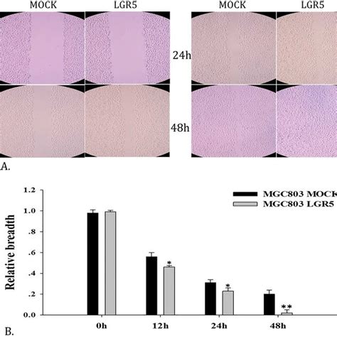 Cell Migration Analysis By Wound Healing Assays Mgc Cells