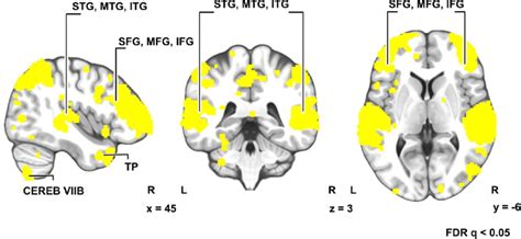 Inter Subject Correlation Isc Of Bold Signals Frd Corrected Q