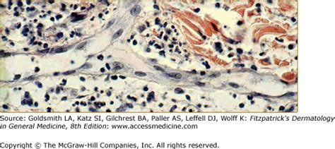 Endothelium in Inflammation and Angiogenesis | Plastic Surgery Key