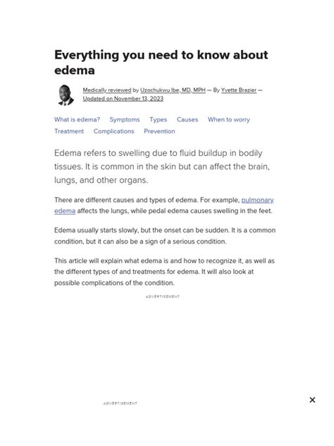 Edema - Types, Causes, Symptoms, and Treatment | PDF | Edema | Vein