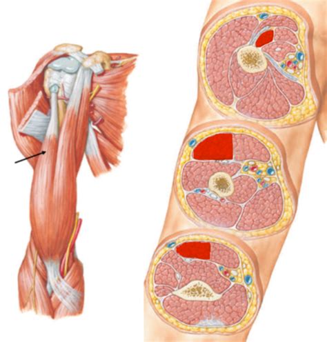 Anterior Compartment Of Arm Flashcards Quizlet