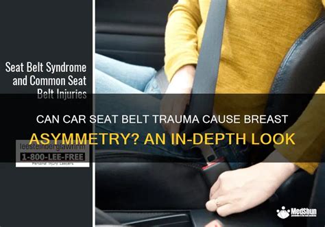 Can Car Seat Belt Trauma Cause Breast Asymmetry An In Depth Look Medshun