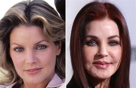 Priscilla Presley Before And After Plastic Surgery Oh My God In