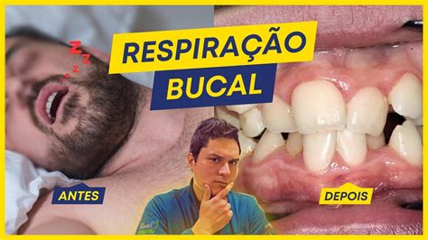 O Que Acontece Quem Respira Pela Boca Youtube